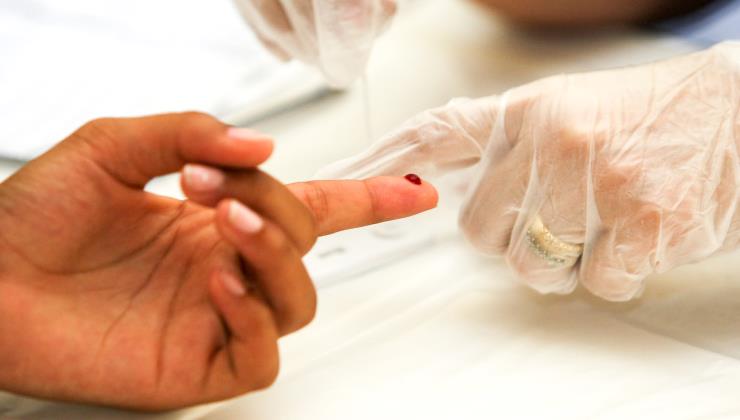 Prevenção: testes de HIV serão realizados em SP nesta quinta-feira (8)